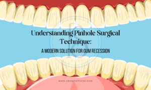 Understanding Pinhole Surgical Technique: A Modern Solution for Gum Recession