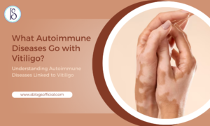 What Autoimmune Diseases Go with Vitiligo? Understanding Autoimmune Diseases Linked to Vitiligo