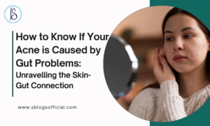 how to know if your acne is caused by gut problems