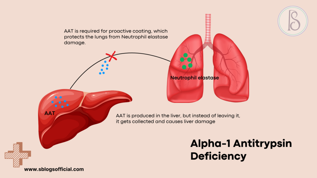 Acute Liver Failure in Infant- Alpha-1 Antitrypsin 