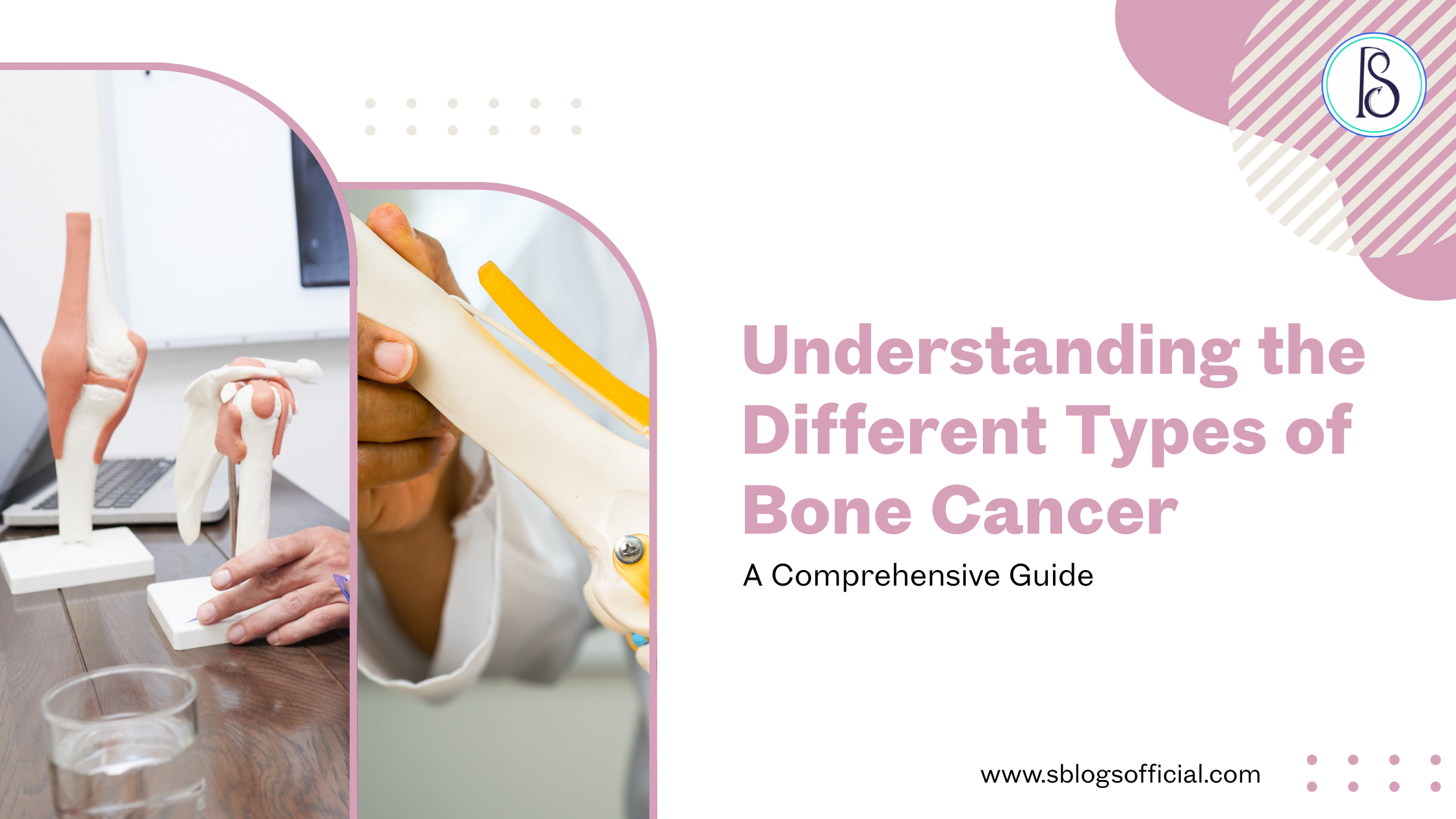 Understanding the Different Types of Bone Cancer: A Comprehensive Guide
